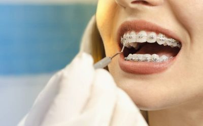 Orthodontie : pourquoi les traitements sont-ils autant redoutés ?