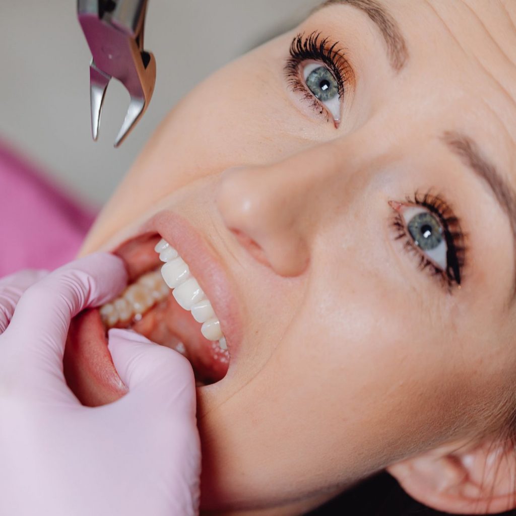 🩺 Gérez efficacement la douleur après extraction d'une dent de sagesse avec nos conseils pratiques. De l'anesthésie à la guérison, nous vous guidons ! 🏥