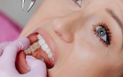 Gérer la douleur après l’extraction d’une dent de sagesse : Nos conseils